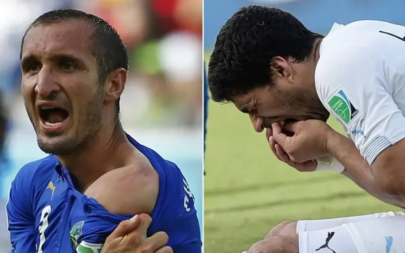 luis-suarez-megmutatja-a-fogait luis-suarez-megmutatja-a-fogait